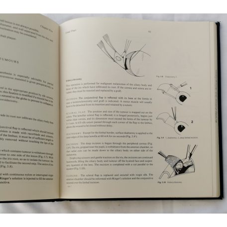 E. D. Dorrell - J. R. O. Collin: Surgery of the Eye