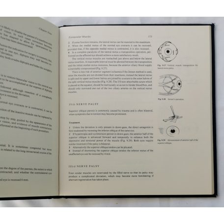 E. D. Dorrell - J. R. O. Collin: Surgery of the Eye